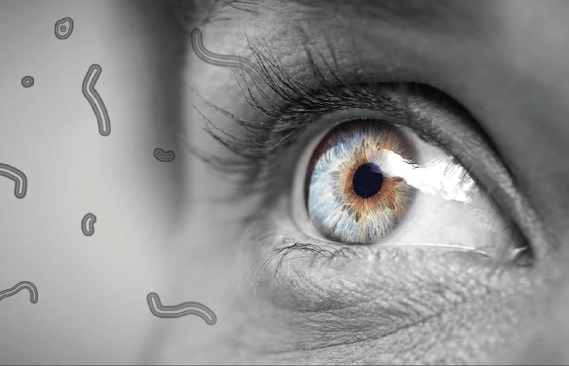 What are Eye Floaters? Understanding the Causes, Symptoms, and ...